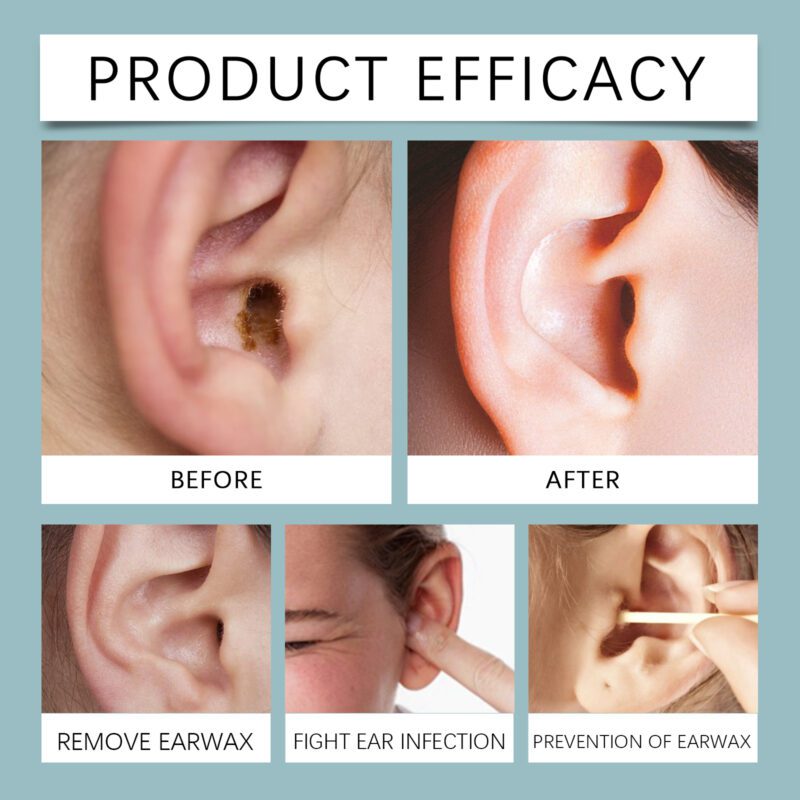 Daily Ear Care Spray - Gentle Natural Soothing Ear Comfort - Image 3