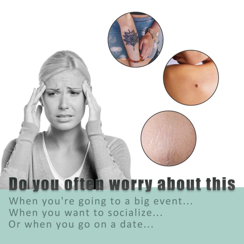 Daily Skin Cover Tape - Gentle Blemish Cover Tape for Scars, Tattoos, Waterproof - Image 4