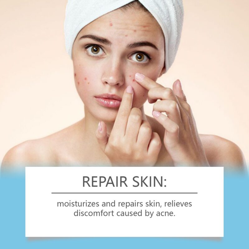 Gentle Daily Care Cream - Natural Extracts for Acne-Prone Skin, Smooth & Calm - Image 4