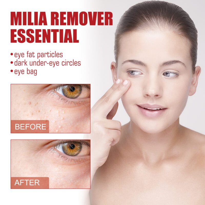 Gentle Eye Care Granules with Natural Ingredients for Daily Nourishment & Moisture - Image 3