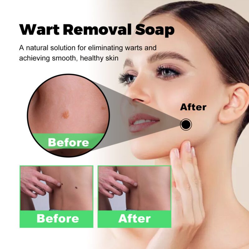 Gentle Nourishing Soap with Tea Tree & Aloe - Daily Care Smooth Skin - Image 4