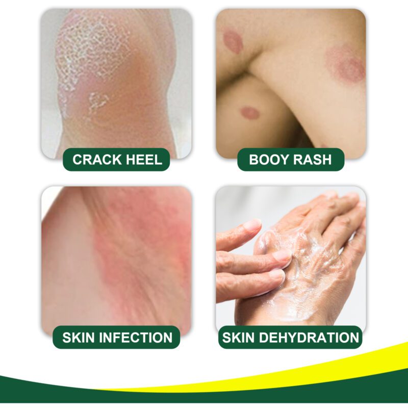 Herbal Soothing Body Cream with Aloe, Honey & Avocado for Daily Skin Care - Image 3