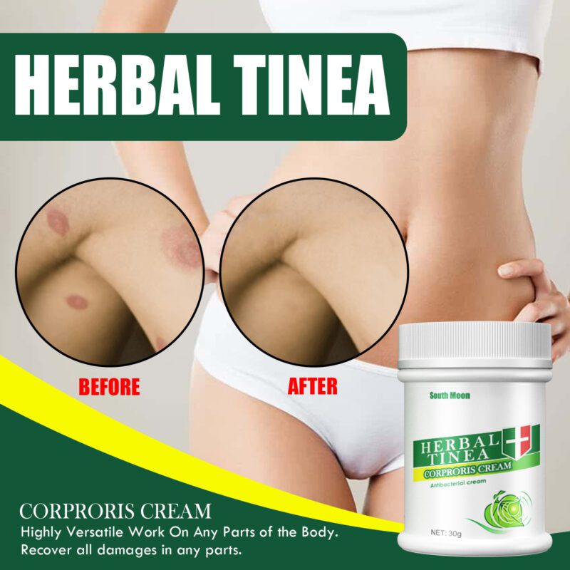 Herbal Soothing Body Cream with Aloe, Honey & Avocado for Daily Skin Care - Image 6