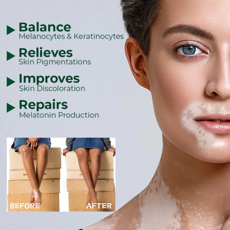 Natural Body Cream: Gentle Daily Care for Soft, Nourished Skin - Image 3