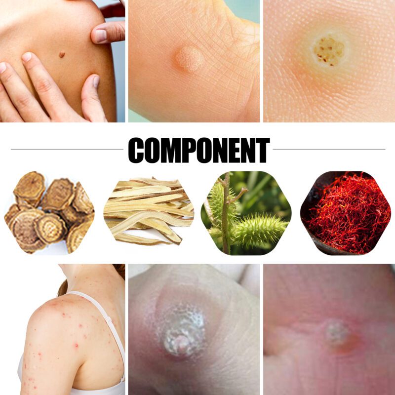 Natural Foot Care Patches - Daily Soothing & Nourishing for Soft Feet - Image 4