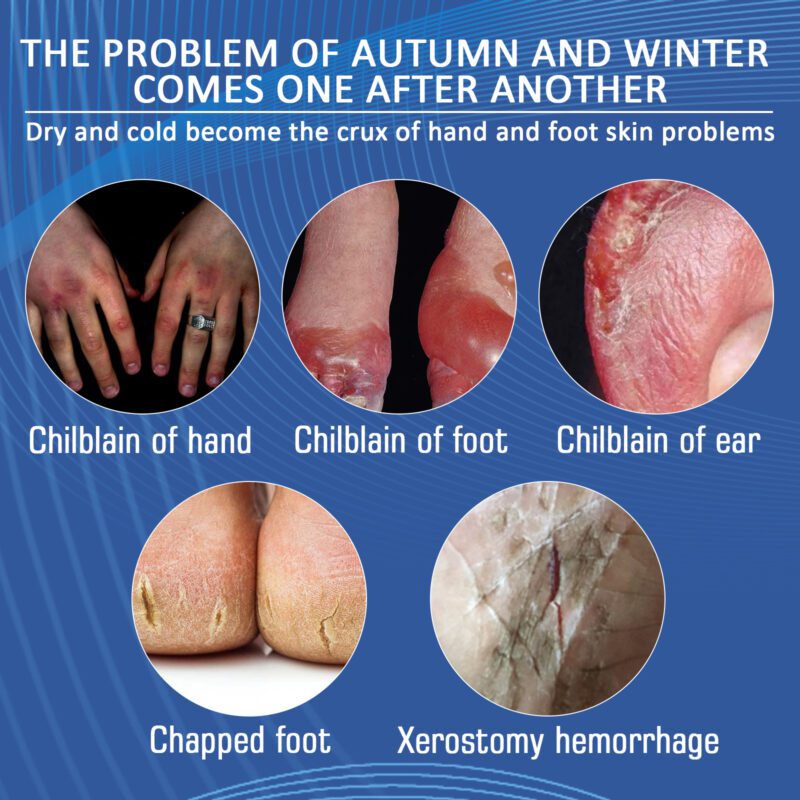 Natural Herbal Hand & Foot Cream for Dry, Cracked Skin - Daily Moisturizing Care - Image 4