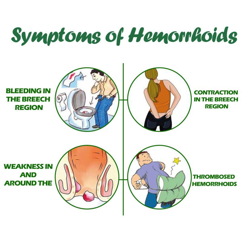 Natural Herbal Hemorrhoid Spray - Gentle Daily Care for Soothing Comfort - Image 4