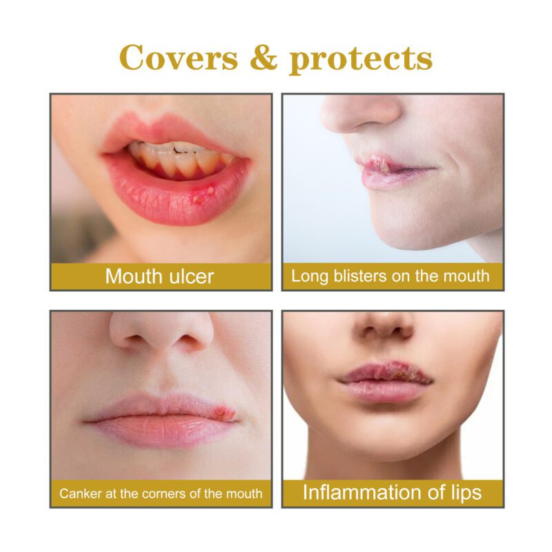 Natural Honey Lip Patch Gentle Daily Care for Soothed Lips - Image 3