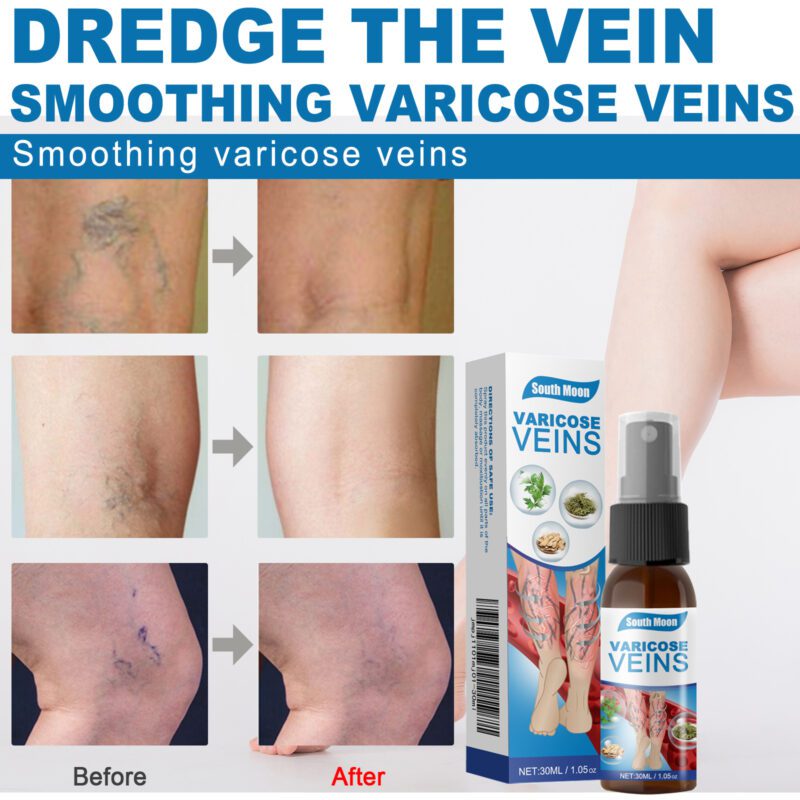 Natural Leg Care Spray - Daily Herbal Nourishment for Soft, Soothed Skin - Image 4