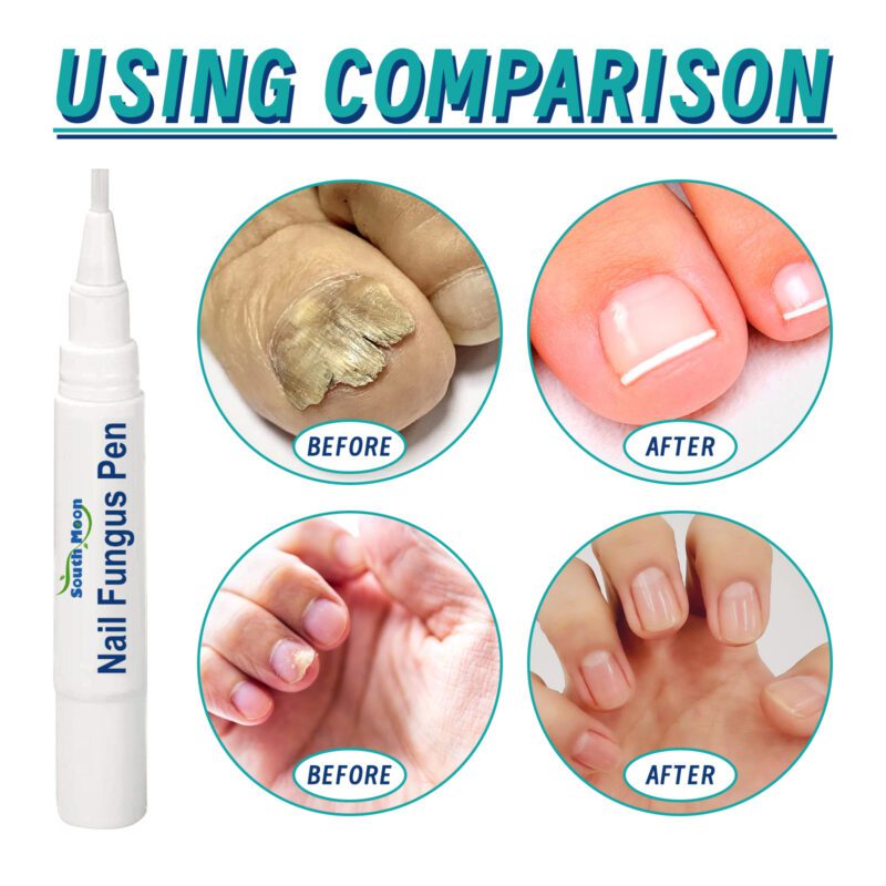 Natural Nail Care Pen with Tea Tree & Vitamin E for Soft Nails - Image 4