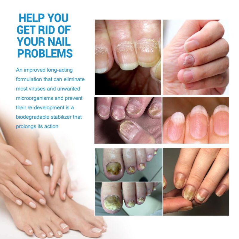 Natural Nail Revitalizer Spray with Shea Butter & Clove Oil for Soft Shiny Nails - Image 3