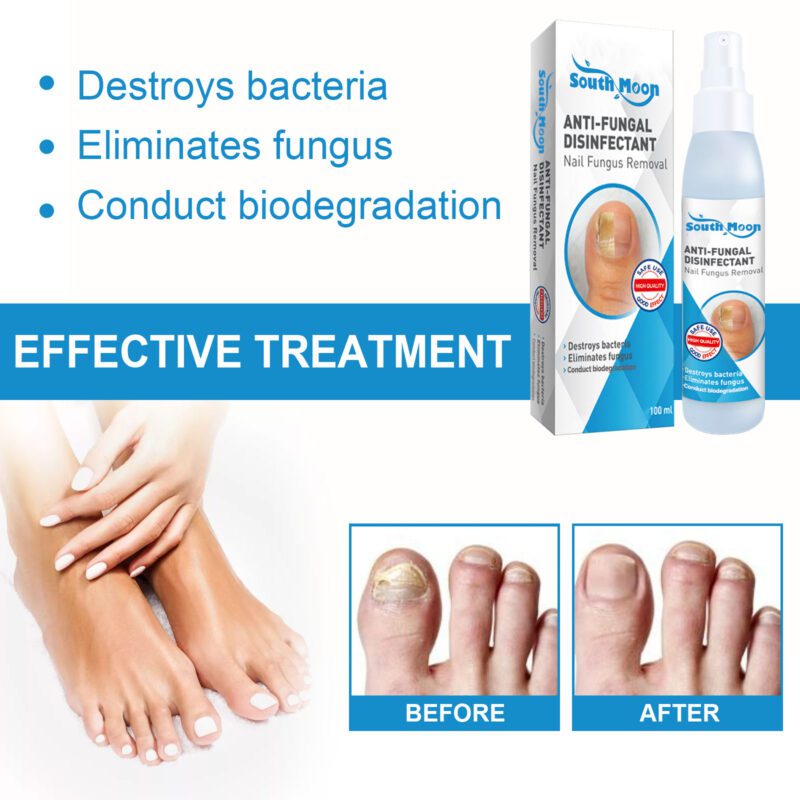 Natural Nail Revitalizer Spray with Shea Butter & Clove Oil for Soft Shiny Nails - Image 4