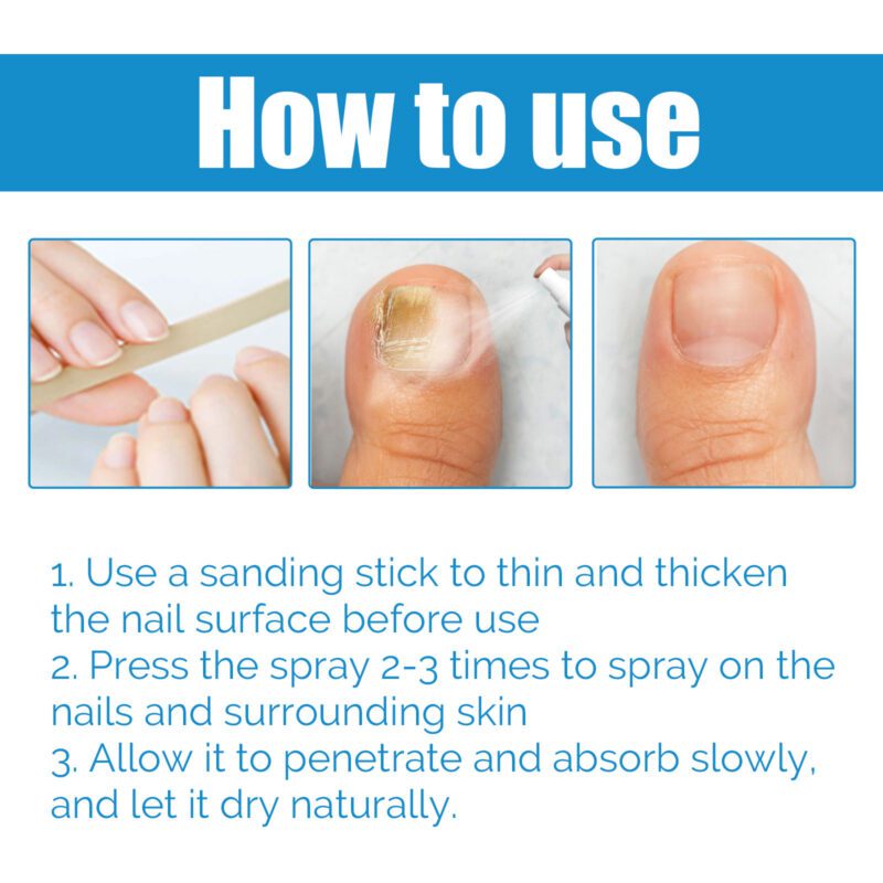Natural Nail Revitalizer Spray with Shea Butter & Clove Oil for Soft Shiny Nails - Image 6