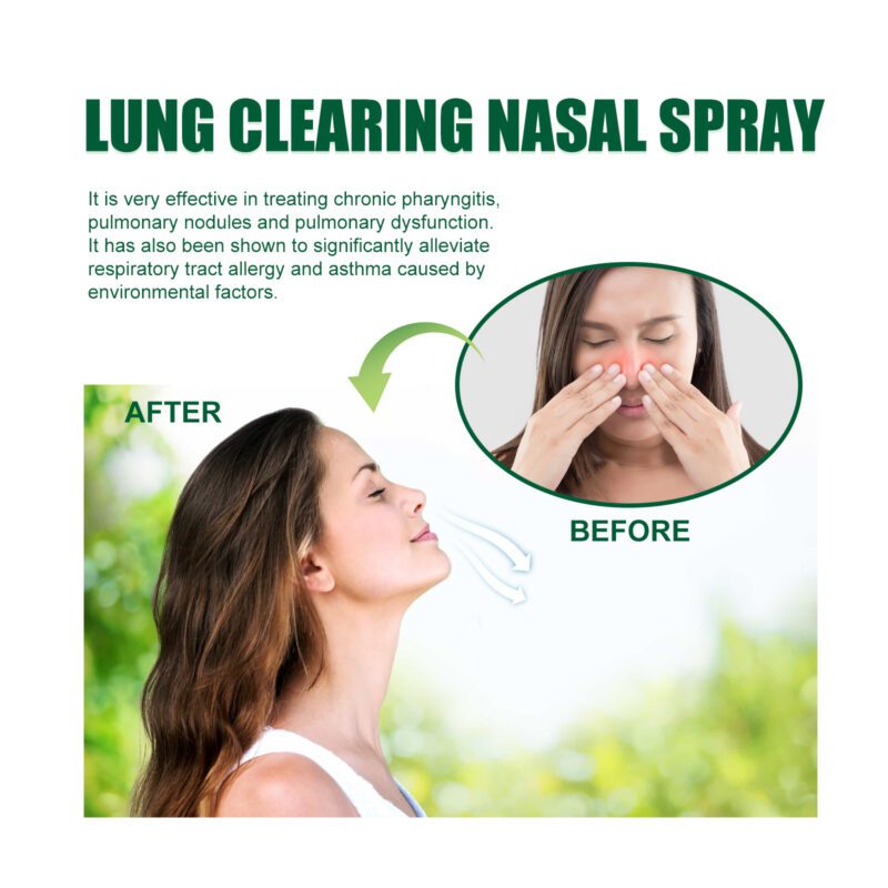 Natural Nasal Soothe Spray: Gentle Daily Care with Quercetin, Elderflower - Image 4