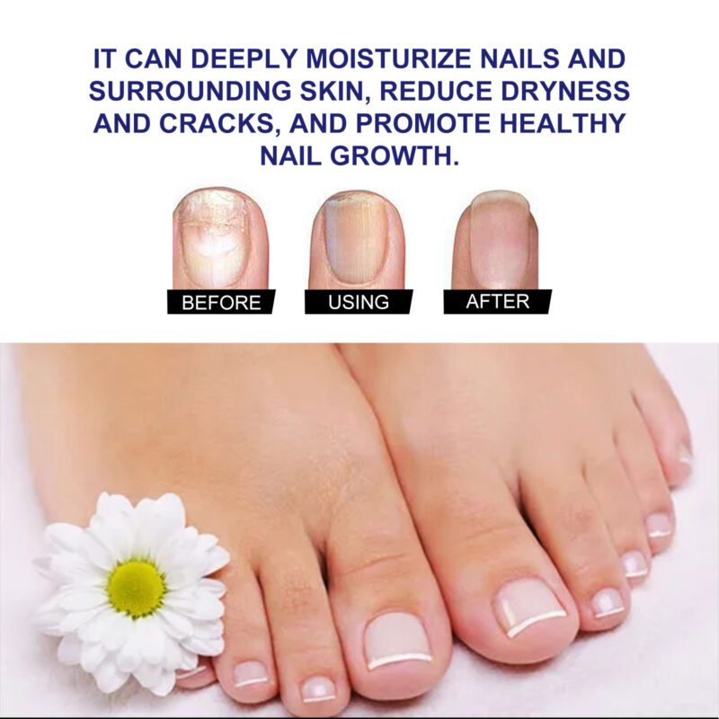 Natural Plant Drops - Gentle Daily Nail Care for Healthy, Shiny Nails - Image 4