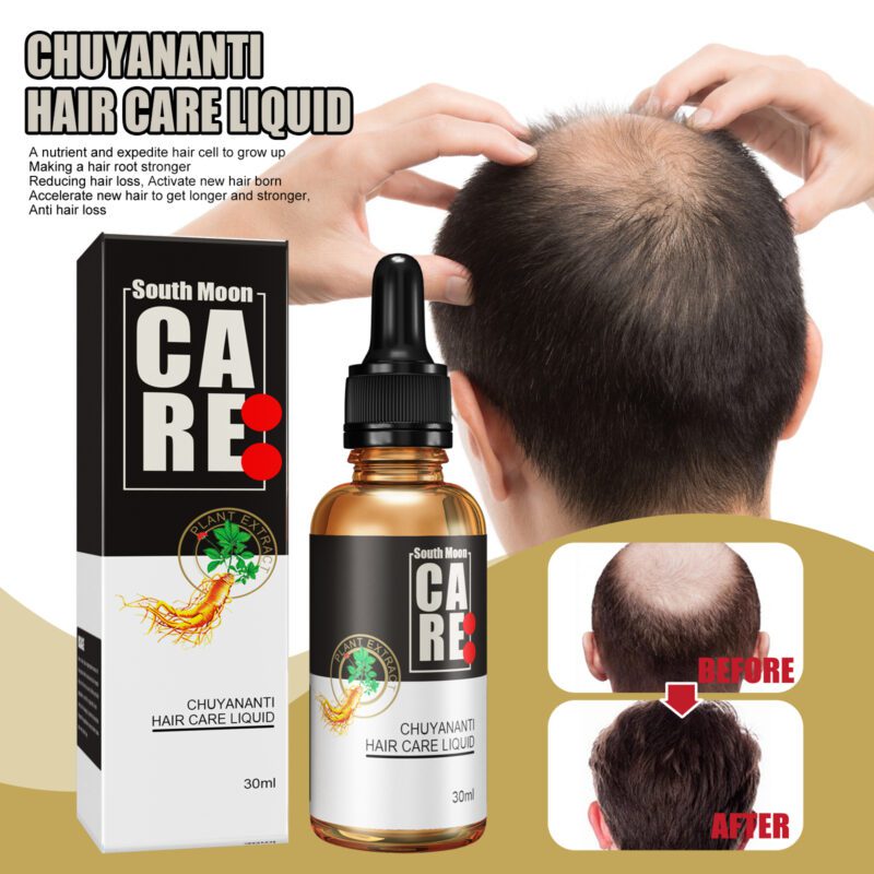 Natural Scalp Lotion - Gentle Daily Massage for Healthier Hair - Image 2