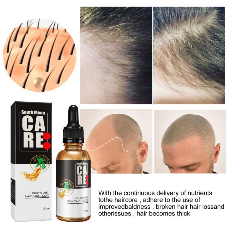 Natural Scalp Lotion - Gentle Daily Massage for Healthier Hair - Image 3