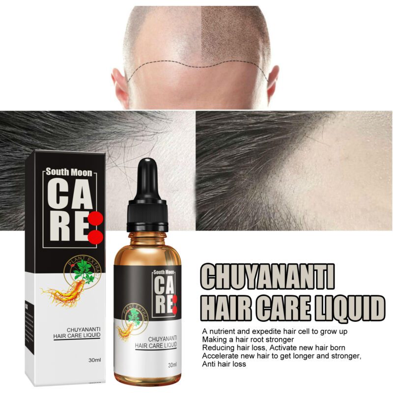 Natural Scalp Lotion - Gentle Daily Massage for Healthier Hair - Image 4