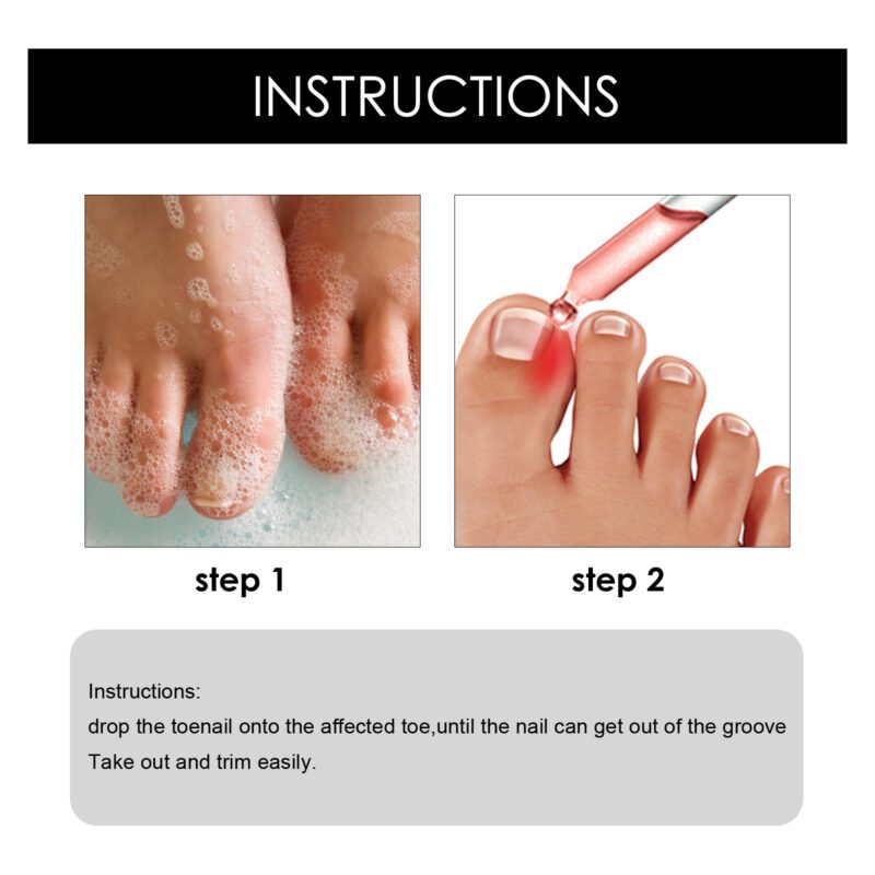Natural Toenail Care Oil, 30ml - Moisturizing & Brightening Treatment - Image 5