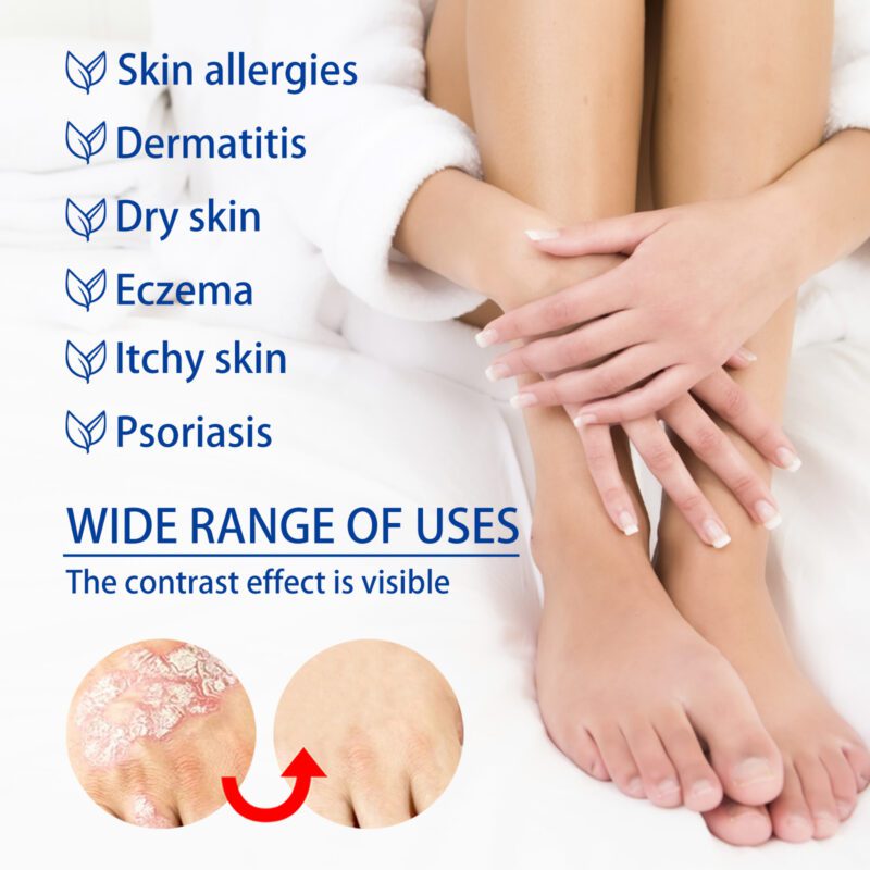 Nurturing Moisturizing Cream - Daily Care for Soft, Soothed Skin - Image 4