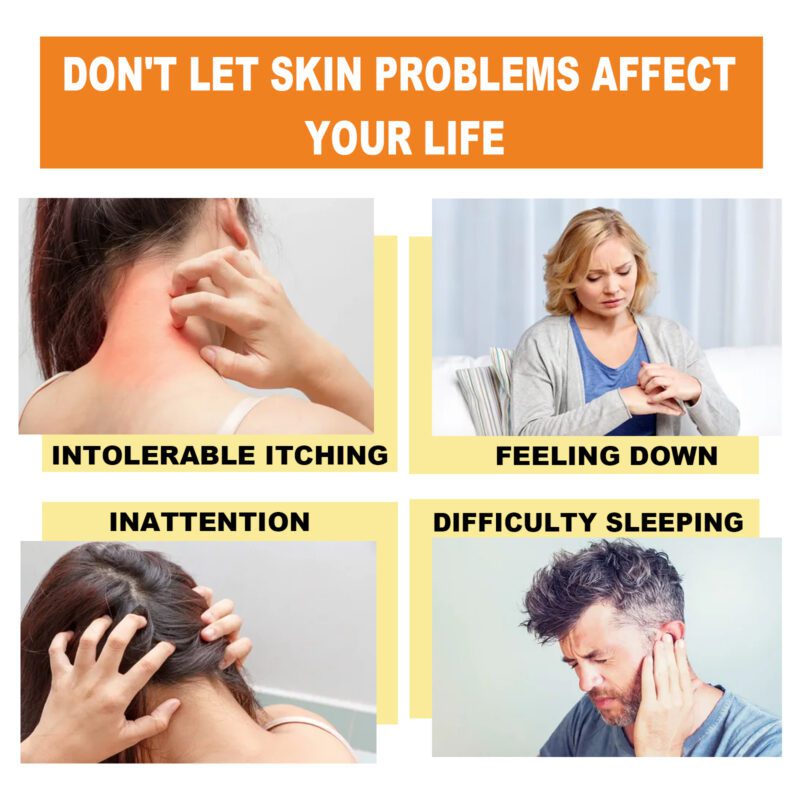 Soothing Bee Venom Cream - Natural Daily Care for Itchy Skin, Moisturizing Comfort - Image 3