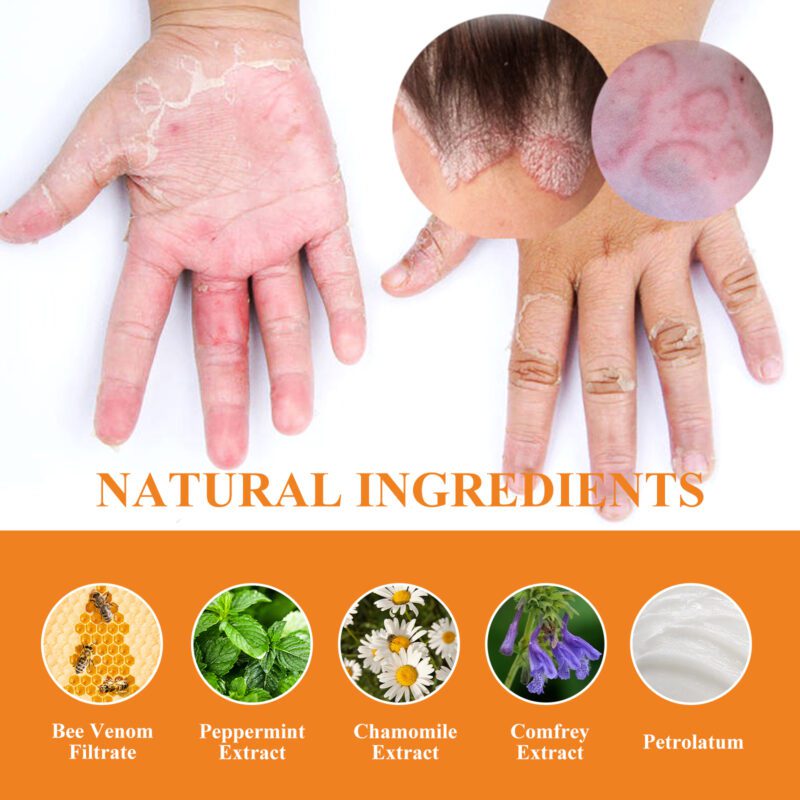 Soothing Bee Venom Cream - Natural Daily Care for Itchy Skin, Moisturizing Comfort - Image 5