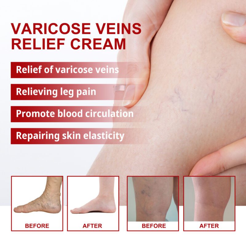 Soothing Leg Cream with Natural Oat & Herbs for Daily Moisture - Image 3