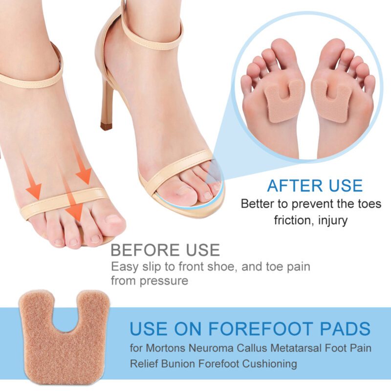 U-Shaped Felt Anti-Friction Pads for Daily Foot Comfort & Blister Prevention - Image 3