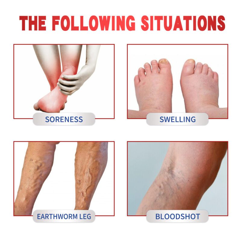 Leg Comfort Patch - Natural Earthworm Formula for Daily Leg Care - Image 4