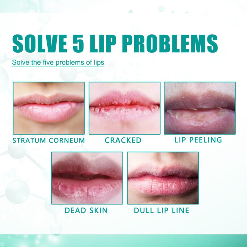 Daily Lip Nourisher – Gentle Care for Smooth, Supple Lips - Image 4