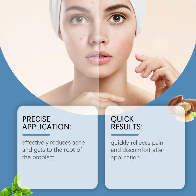 Soothing Skin Pen with Lavender & Castor Oils - Daily Care - Image 3