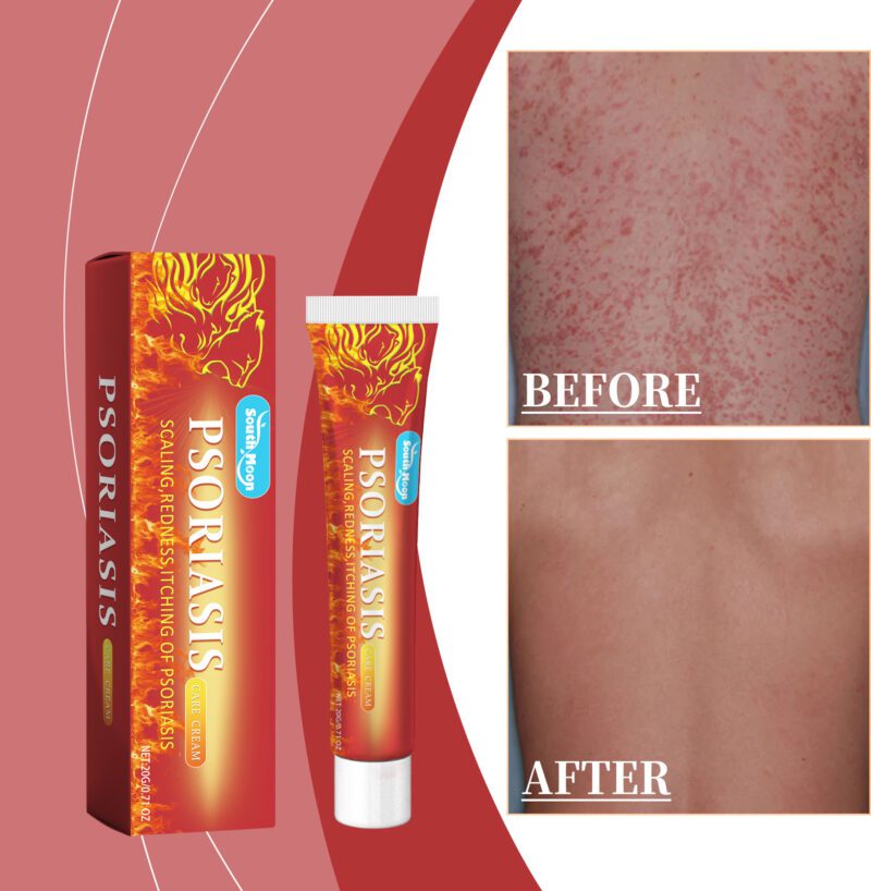 Gentle Daily Moisturizing Cream with Glycerin - Soothe & Nourish Dry Skin - Image 2