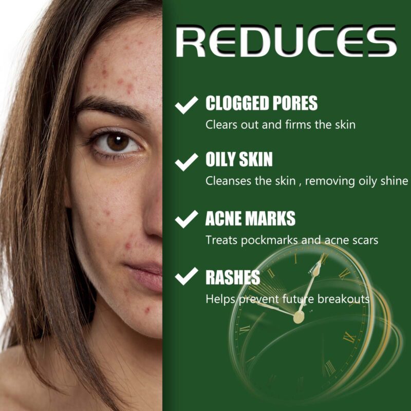 Gentle Daily Care Cream - Acne Soothing Treatment, Fade Marks, Soft Glow Skin - Image 4