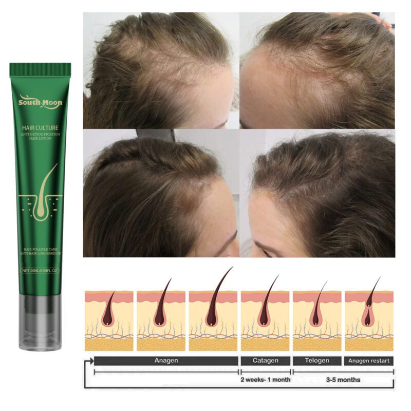 Ginger Scalp Care: Gentle Nurture for Dry Hair - Image 4