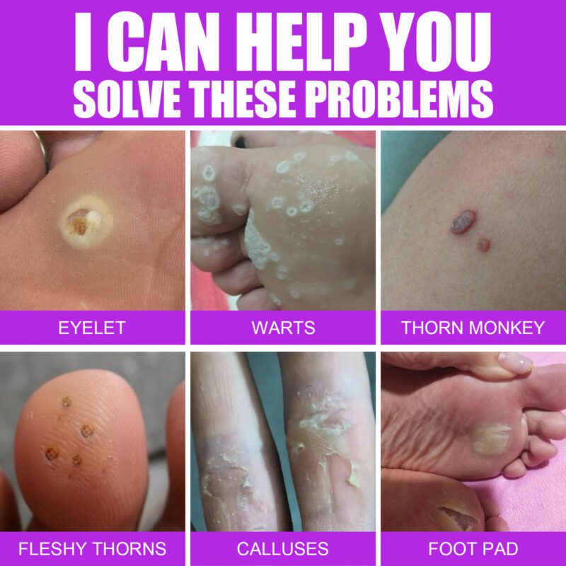 Gentle Foot Care Lotion - Natural Ingredients for Smooth, Healthy Feet - Image 4