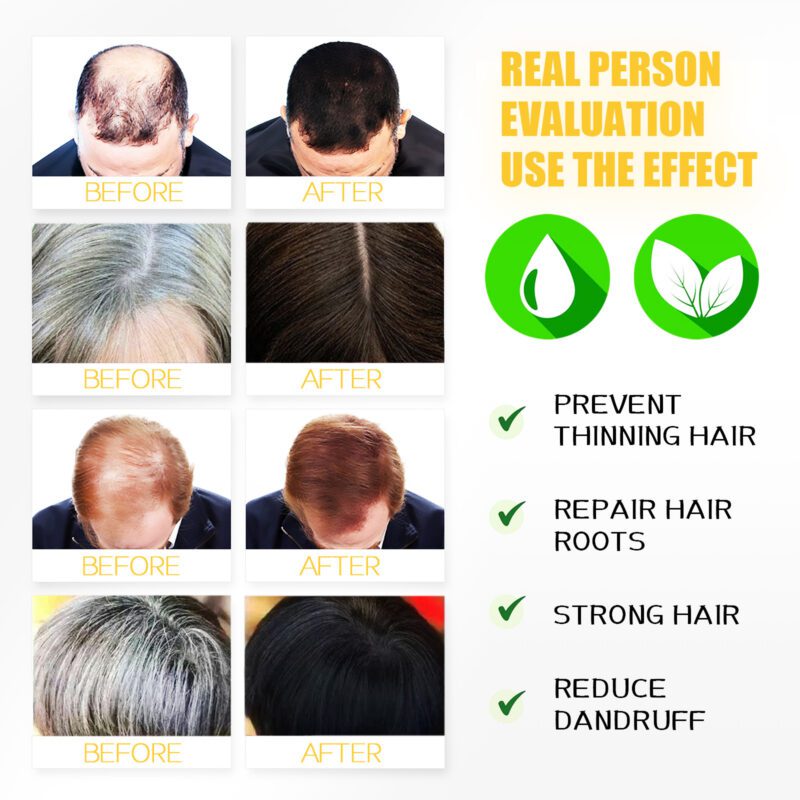 Daily Care Herbal Shampoo Bag - Ginger Essence for Soft, Shiny Hair - Image 4