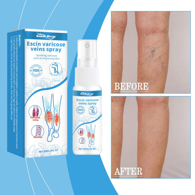 Natural Leg Care Spray | Vitamin C & Anthocyanin Complex for Daily Use - Image 2