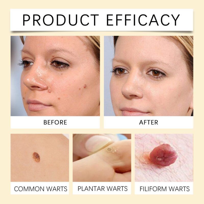 Natural Bee Venom & Tea Tree Skin Care Spray for Daily Soothing and Smooth Skin - Image 4
