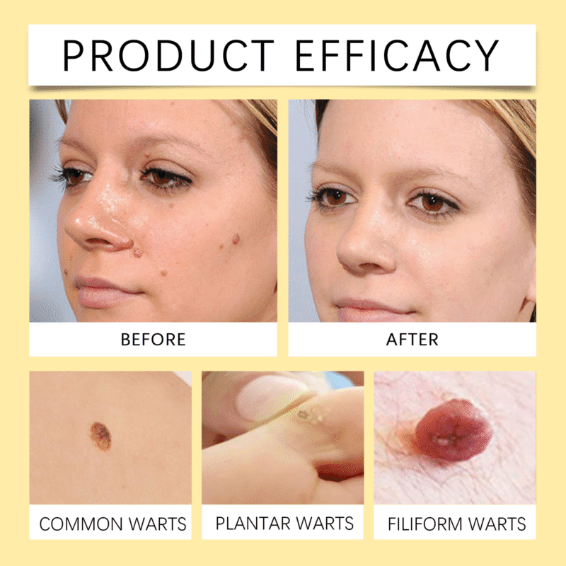 Natural Bee Venom Skin Care Spray - Gentle Daily Care for Soothed, Smooth Skin - Image 3