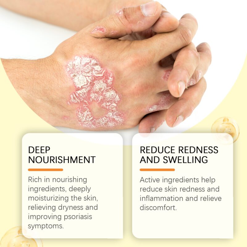 Daily Skin Spray with Aloe & Peppermint for Body, Hands, Feet - Image 3