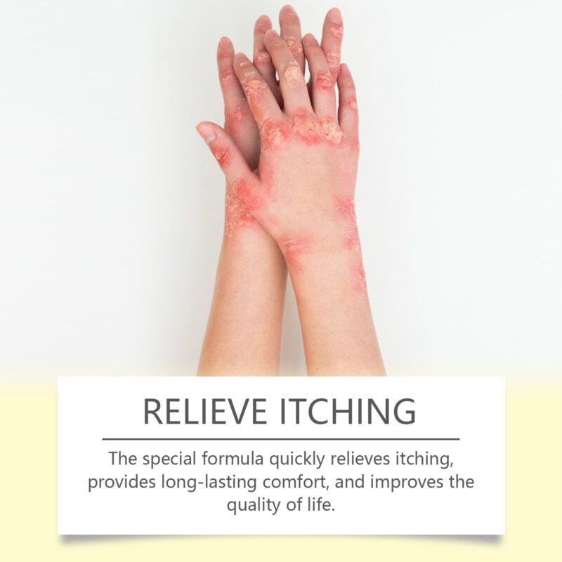 Daily Hand & Foot Care Patches - Natural Moisturizing for Soft Skin - Image 4