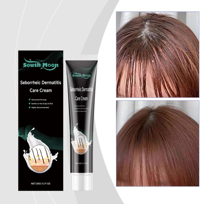 Scalp Nourish Cream - Gentle Natural Formula for Daily Comfort & Care - Image 2