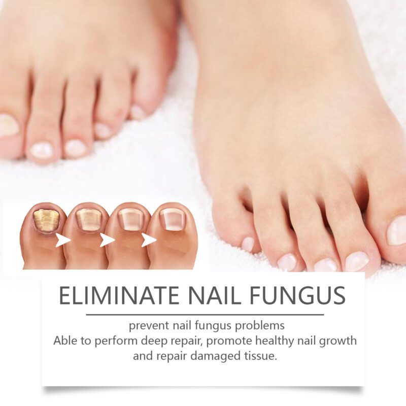 Natural Nail Care Pen with Honeysuckle & Lavender for Healthy Nails - Image 4