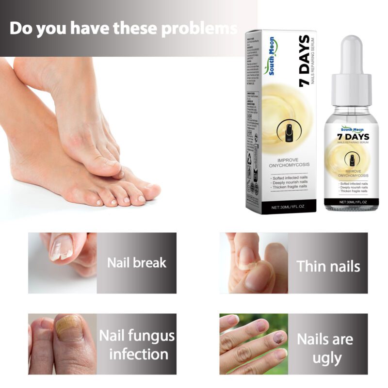 Natural Nail Care Serum - Gentle Daily Care for Soft, Shiny Hands & Feet - Image 3