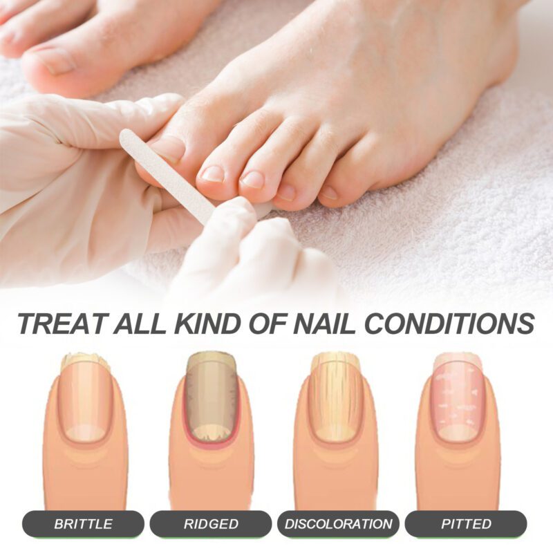 Natural Nail Care Serum - Gentle Daily Care for Soft, Shiny Hands & Feet - Image 4