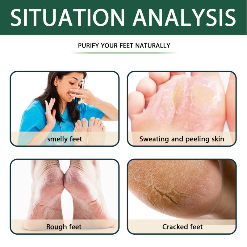 Natural Foot Bath Gel – Soothing Daily Care with Botanical Extracts - Image 4