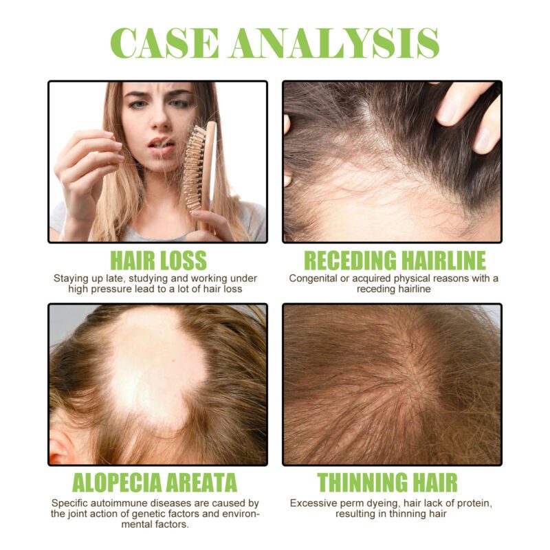 Ginger Shampoo for Healthy Shiny Hair - Natural Daily Care - Image 3
