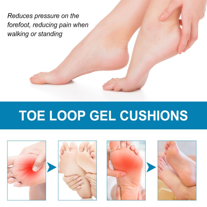 Soft Gel Metatarsal Pads - Gentle Daily Foot Care - Image 3