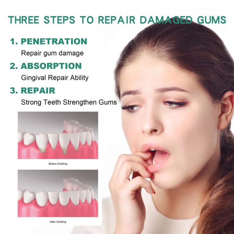 Natural Gum Care Drops - Soothing Oral Support with Freshness - Image 3