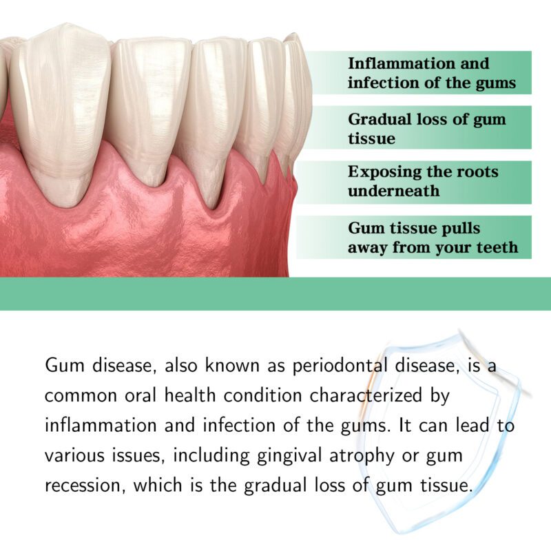 Natural Gum Care Drops - Soothing Oral Support with Freshness - Image 4